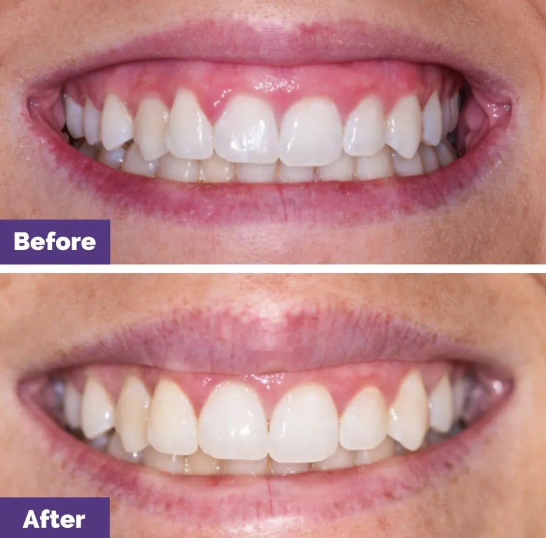 Treatment area at VIVA Orthodontics in Bountiful, UT